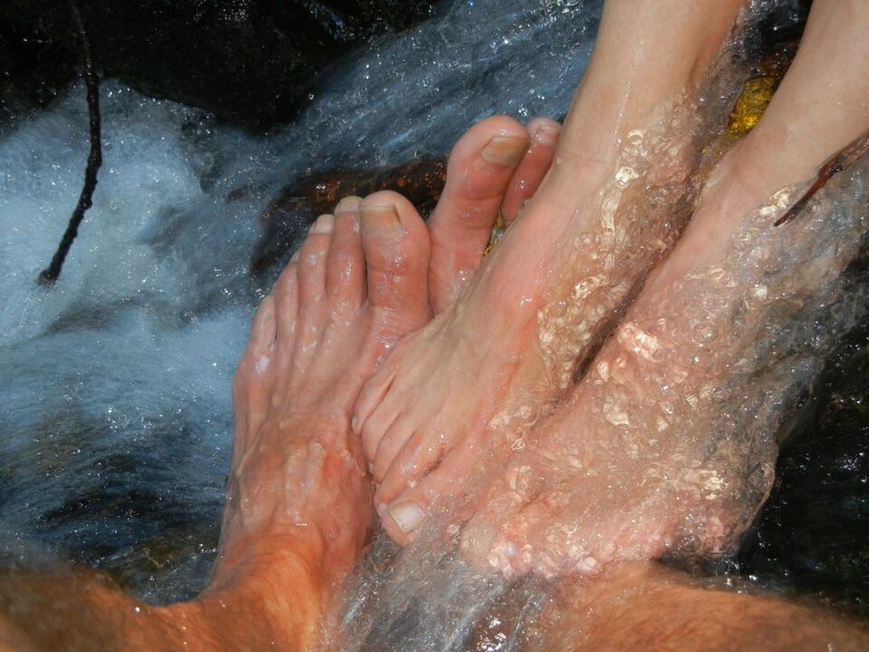 Mycosis nail legs